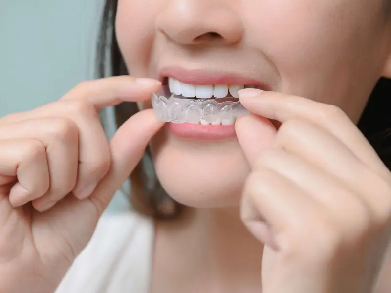 Can I Straighten My Teeth at Any Age?